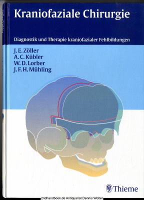 Kraniofaziale Chirurgie : Diagnostik und Therapie kraniofazialer Fehlbildungen ; 16 Tabellen