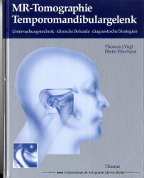 MR-Tomographie Temporomandibulargelenk : Untersuchungstechnik, klinische Befunde, diagnostische Strategien ; 18 Tabellen